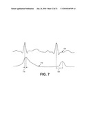 ELECTRODE DATA ANALYSIS TO INDICATE CATHETER STABILITY AND/OR NEEDLE PENETRATION SUCCESS diagram and image