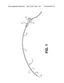 Adaptable Image Guided Delivery System diagram and image