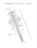 REVERSE DEPLOYMENT DEVICE diagram and image