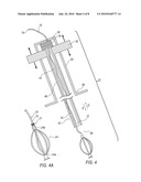 REVERSE DEPLOYMENT DEVICE diagram and image