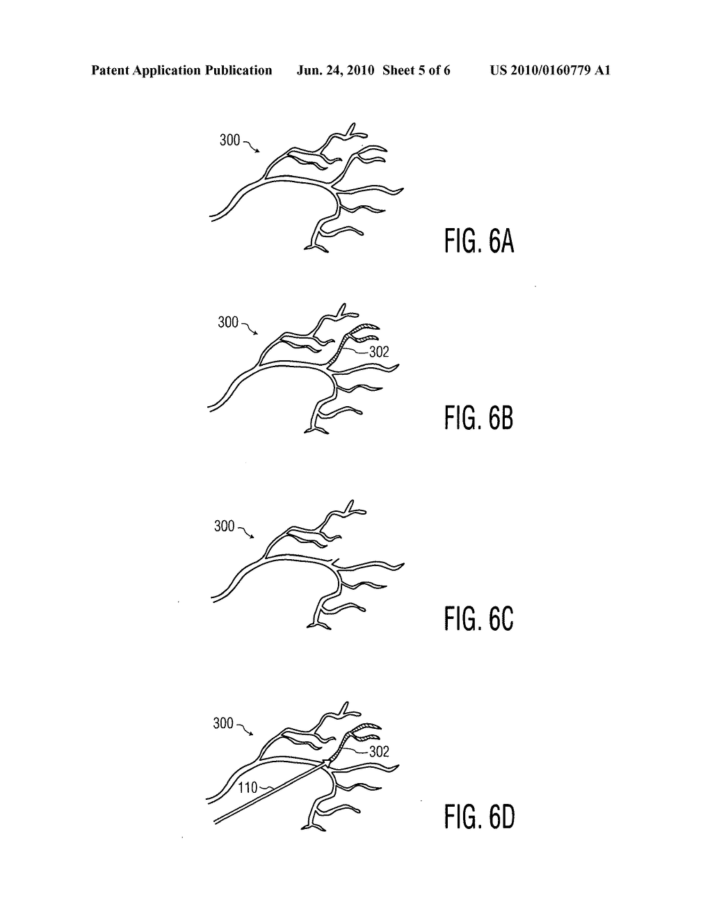 ULTRASOUND SYSTEM FOR CEREBRAL BLOOD FLOW IMAGING AND MICROBUBBLE-ENHANCED BLOOD CLOT LYSIS - diagram, schematic, and image 06