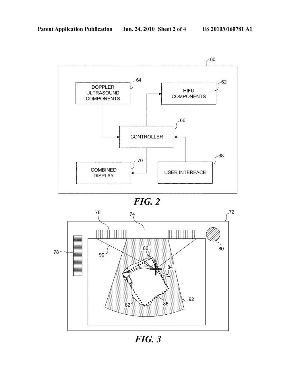 DOPPLER AND IMAGE GUIDED DEVICE FOR NEGATIVE FEEDBACK PHASED ARRAY HIFU TREATMENT OF VASCULARIZED LESIONS - diagram, schematic, and image 03