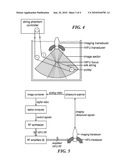 DOPPLER AND IMAGE GUIDED DEVICE FOR NEGATIVE FEEDBACK PHASED ARRAY HIFU TREATMENT OF VASCULARIZED LESIONS diagram and image