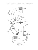 Weight shifting apparatus for an orthopedic sling diagram and image