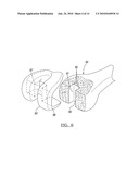 Method for Performing Bone Cutting diagram and image