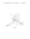 Method for Performing Bone Cutting diagram and image