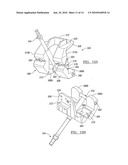 Method for Performing Bone Cutting diagram and image