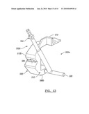 Method for Performing Bone Cutting diagram and image