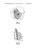 BIOLOGICAL TISSUE GROWTH THROUGH INDUCED TENSILE STRESS diagram and image