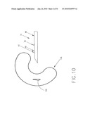 SURGICAL FASTENING SYSTEM AND METHOD FOR USING THE SAME diagram and image