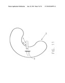 SURGICAL FASTENING SYSTEM AND METHOD FOR USING THE SAME diagram and image