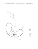 SURGICAL FASTENING SYSTEM AND METHOD FOR USING THE SAME diagram and image