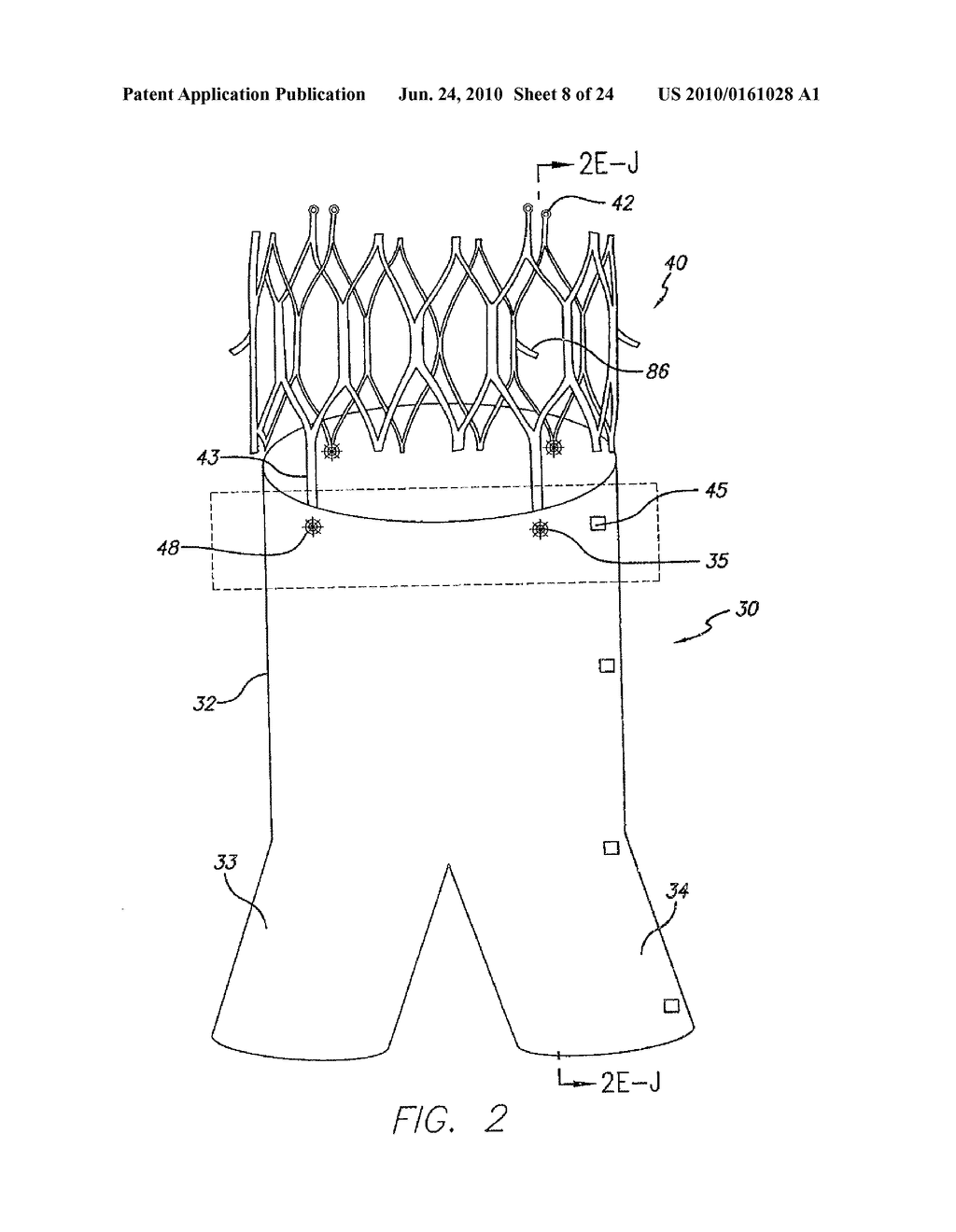 ENDOVASCULAR GRAFT DEVICE AND METHODS FOR ATTACHING COMPONENTS THEREOF - diagram, schematic, and image 09