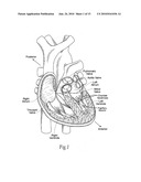 QUICK-CONNECT PROSTHETIC HEART VALVE AND METHODS diagram and image