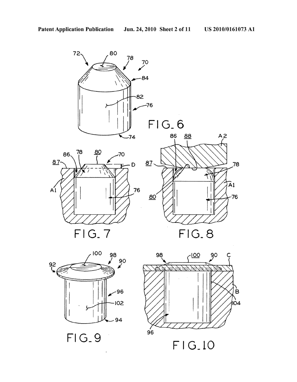 MOSAICPLASTY CONSTRUCTS - diagram, schematic, and image 03