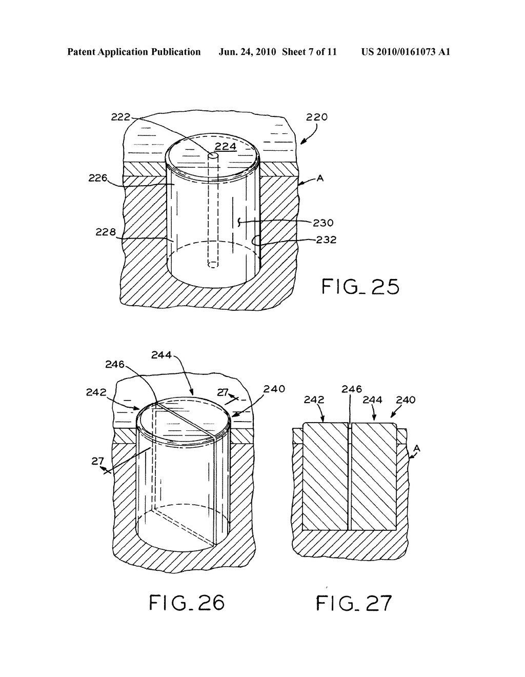 MOSAICPLASTY CONSTRUCTS - diagram, schematic, and image 08