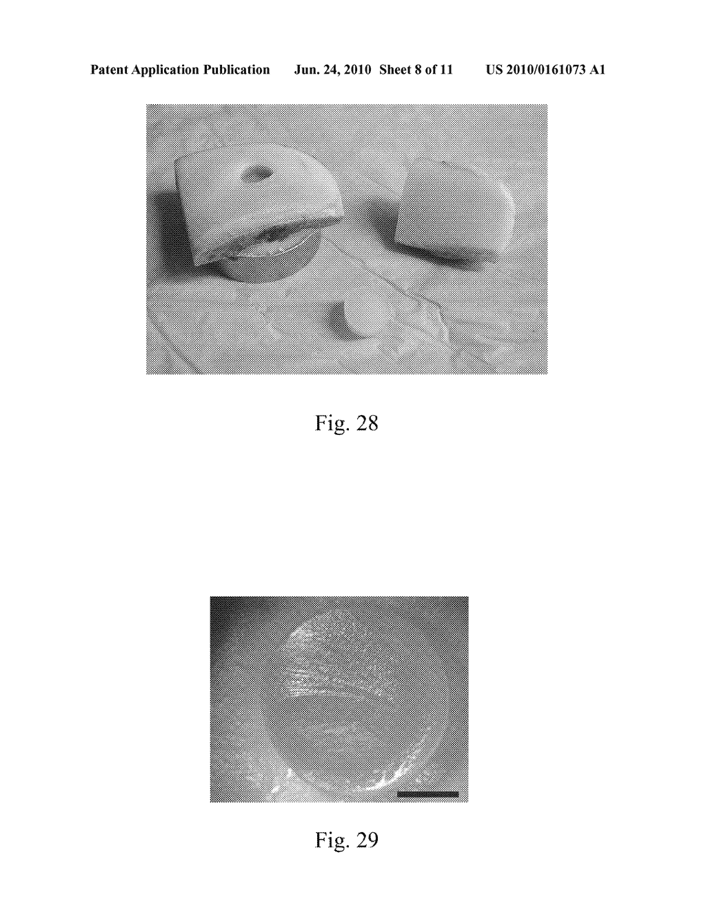 MOSAICPLASTY CONSTRUCTS - diagram, schematic, and image 09