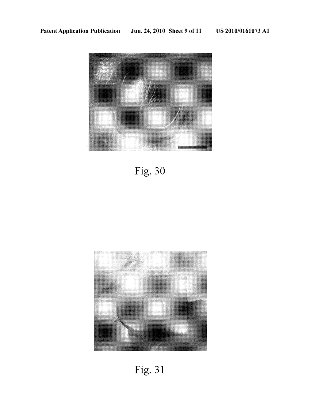 MOSAICPLASTY CONSTRUCTS - diagram, schematic, and image 10