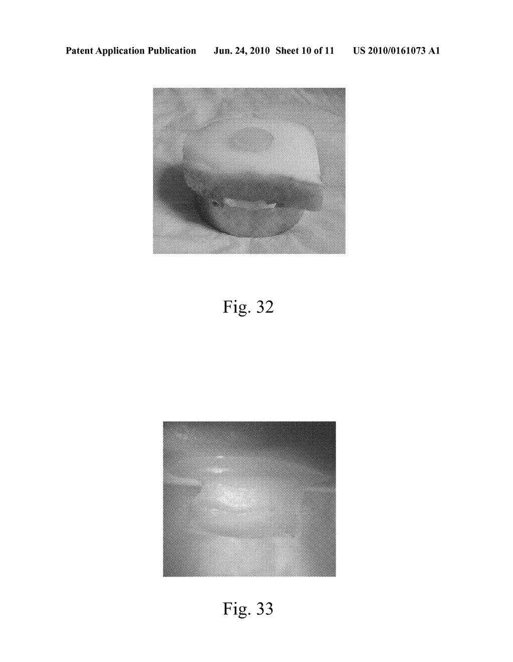 MOSAICPLASTY CONSTRUCTS - diagram, schematic, and image 11