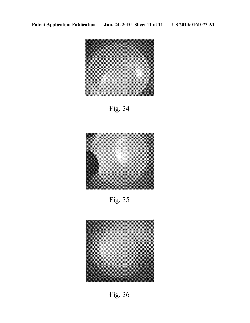 MOSAICPLASTY CONSTRUCTS - diagram, schematic, and image 12