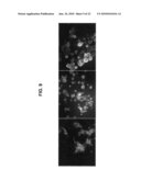 Multi-stage stem cell carcinogenesis diagram and image