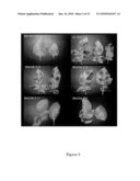 FUNCTIONAL R-GENE FROM SOLANUM BULBOCASTANUM diagram and image