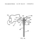 SIPHON FOR DELIVERY OF LIQUID CRYOGEN FROM DEWAR FLASK diagram and image