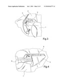 MOTOR VEHICLE DOOR HANDLE WITH REMOVABLE CAP FOR THE LOCK CYLINDER diagram and image