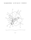 PERSONAL ESCAPE DEVICE diagram and image