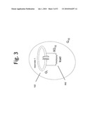 WIRELESS ENERGY TRANSFER USING CONDUCTING SURFACES TO SHAPE FIELDS AND REDUCE LOSS diagram and image