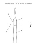 SYSTEM AND METHOD FOR MOSAICING ENDOSCOPE IMAGES CAPTURED FROM WITHIN A CAVITY diagram and image