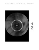 SYSTEM AND METHOD FOR MOSAICING ENDOSCOPE IMAGES CAPTURED FROM WITHIN A CAVITY diagram and image