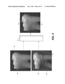 APPARATUS FOR CARIES DETECTION diagram and image