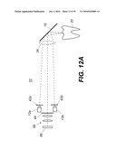 APPARATUS FOR CARIES DETECTION diagram and image