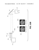 APPARATUS FOR CARIES DETECTION diagram and image