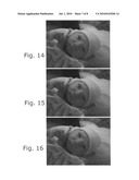 Method and apparatus for noise reduction in video diagram and image