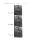 Method and apparatus for noise reduction in video diagram and image