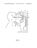 ORTHOVOLTAGE RADIOTHERAPY diagram and image