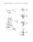 ORTHOVOLTAGE RADIOTHERAPY diagram and image