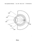 ORTHOVOLTAGE RADIOTHERAPY diagram and image