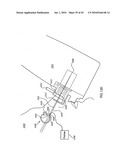 ORTHOVOLTAGE RADIOTHERAPY diagram and image