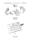 X-RAY DIAGNOSTIC APPARATUS diagram and image