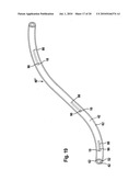 CABLE diagram and image