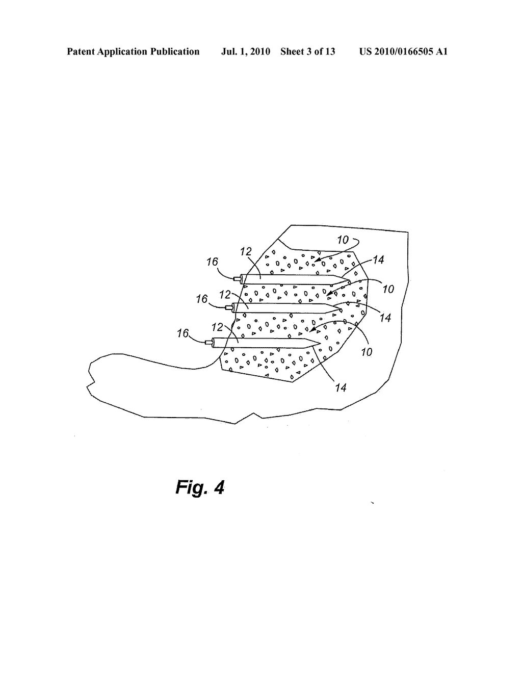 SELF-CENTRALIZING SOIL NAIL AND METHOD OF CREATING SUBSURFACE SUPPORT - diagram, schematic, and image 04