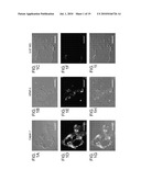 COMPOSITIONS FOR IMPROVING CELLULAR UPTAKE OF A CHEMOTHERAPEUTIC AGENT IN A CELL EXHIBITING MUCIN DEREGULATION diagram and image