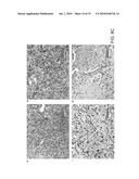 COMPOSITIONS FOR IMPROVING CELLULAR UPTAKE OF A CHEMOTHERAPEUTIC AGENT IN A CELL EXHIBITING MUCIN DEREGULATION diagram and image