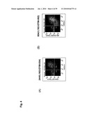 Monoclonal Antibodies Against Claudin-18 for Treatment of Cancer diagram and image