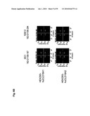 Monoclonal Antibodies Against Claudin-18 for Treatment of Cancer diagram and image