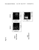 Monoclonal Antibodies Against Claudin-18 for Treatment of Cancer diagram and image