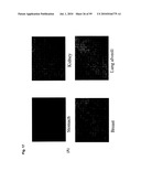 Monoclonal Antibodies Against Claudin-18 for Treatment of Cancer diagram and image